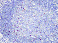 c-MYC Monoclonal Antibody Synonyms c-MYC