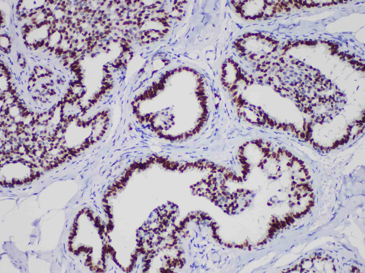 GATA3 Monoclonal Antibody stored at 2~8°C
