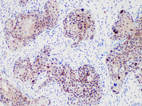 HSP70 Monoclonal Antibody