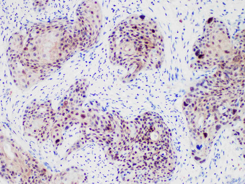 HSP70 Monoclonal Antibody