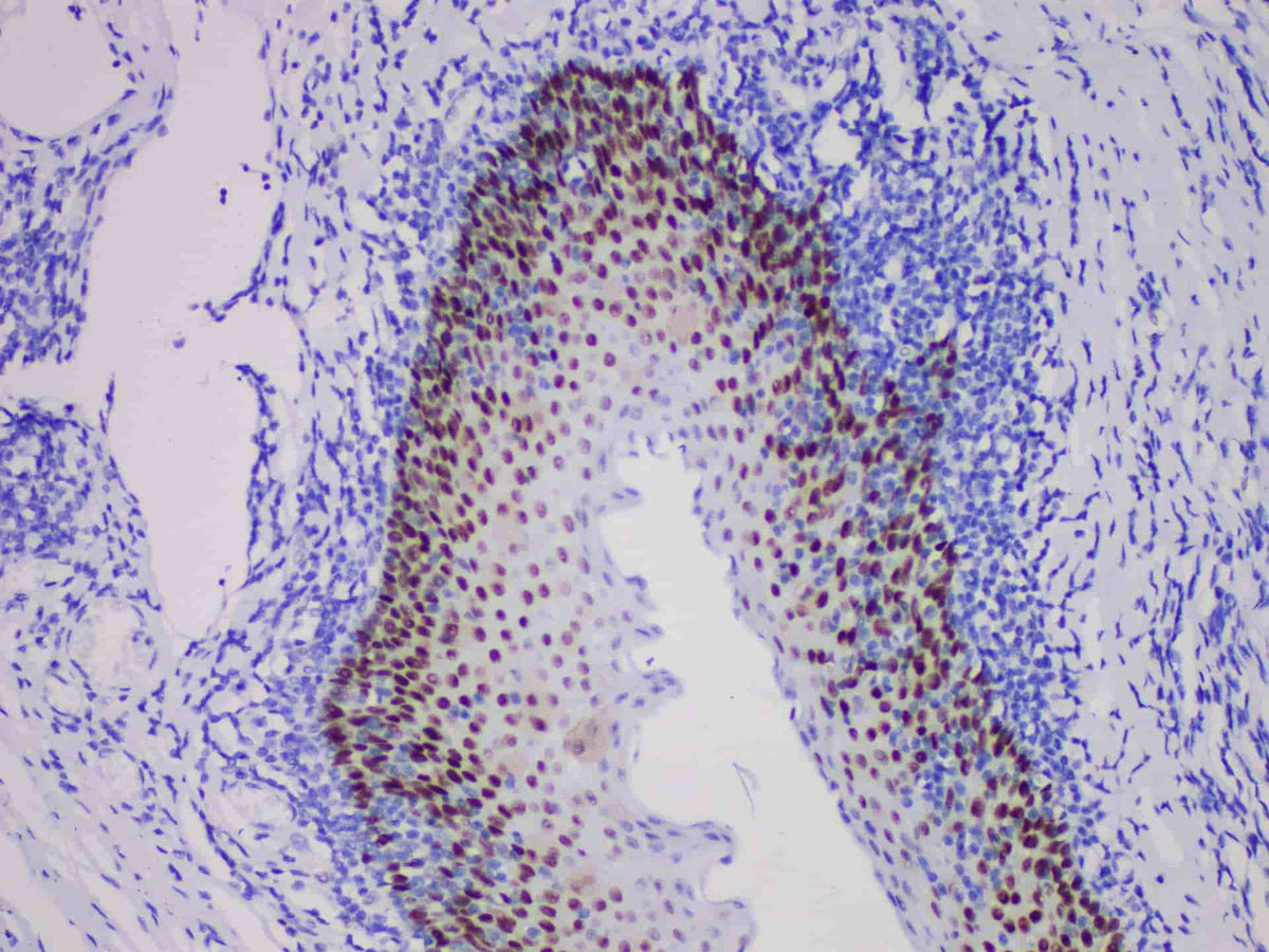 SOX-2 Monoclonal Antibody