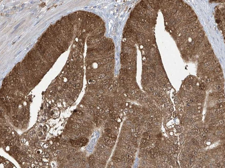 IDH-1 Monoclonal Antibody stored at 2~8°C - MSE Supplies LLC