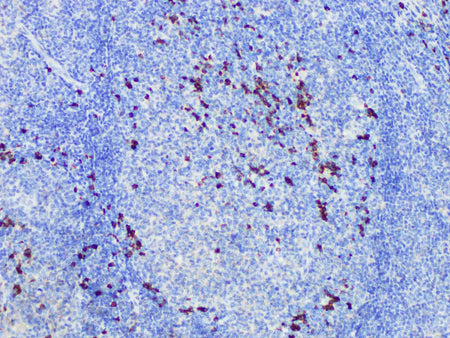 IgG Monoclonal Antibody stored at 2~8°C