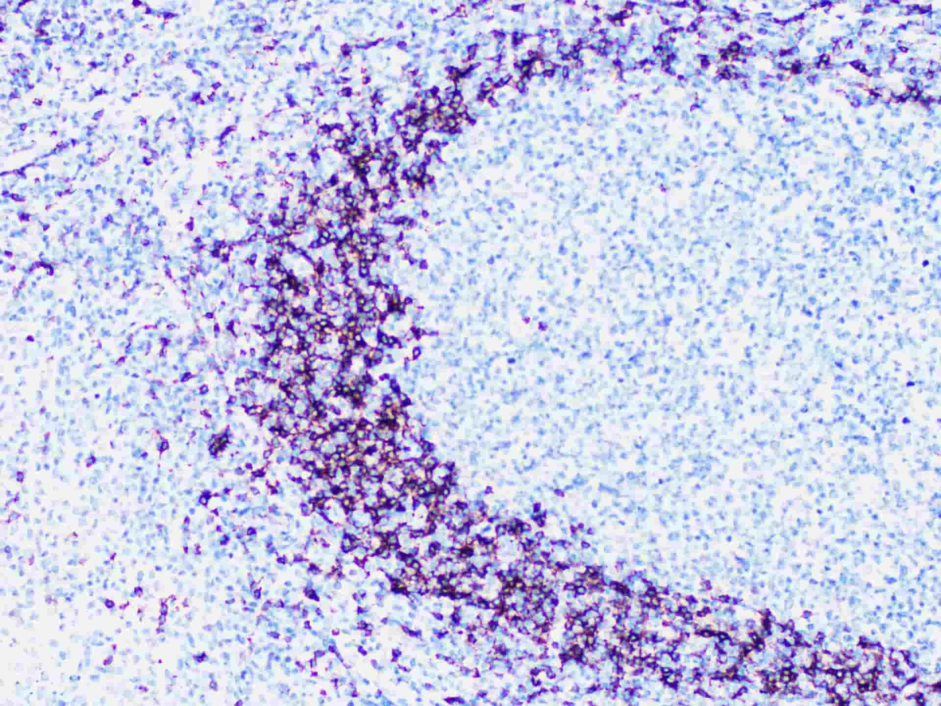 IgD Monoclonal Antibody