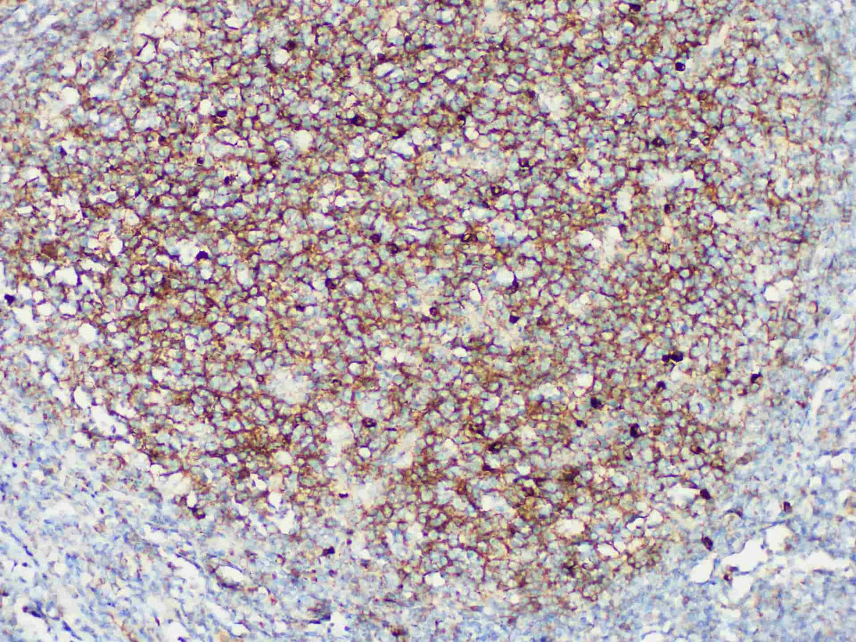 IgM Monoclonal Antibody stored at 2~8°C