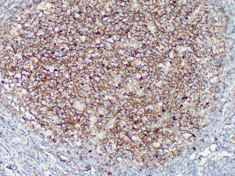 IgM Monoclonal Antibody stored at 2~8°C
