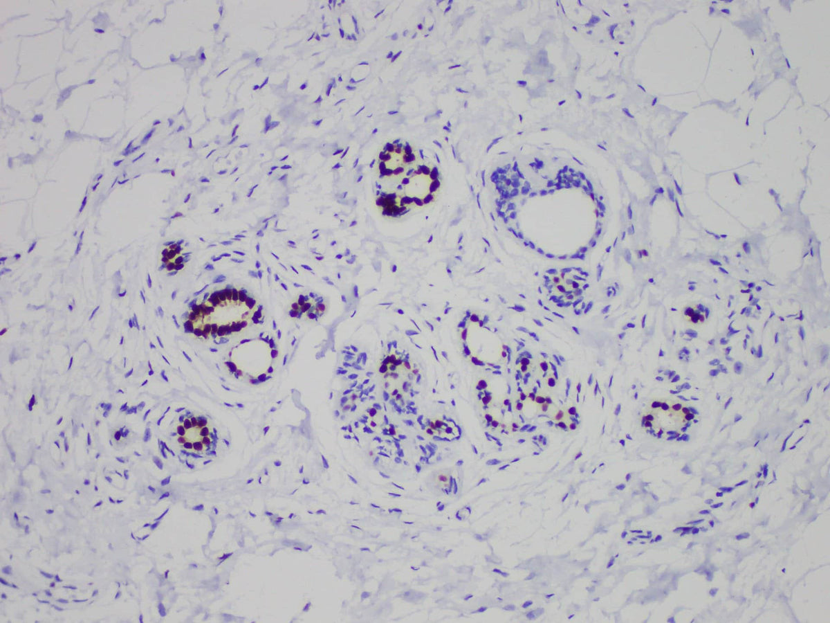 ER Monoclonal Antibody stored at 2~8°C