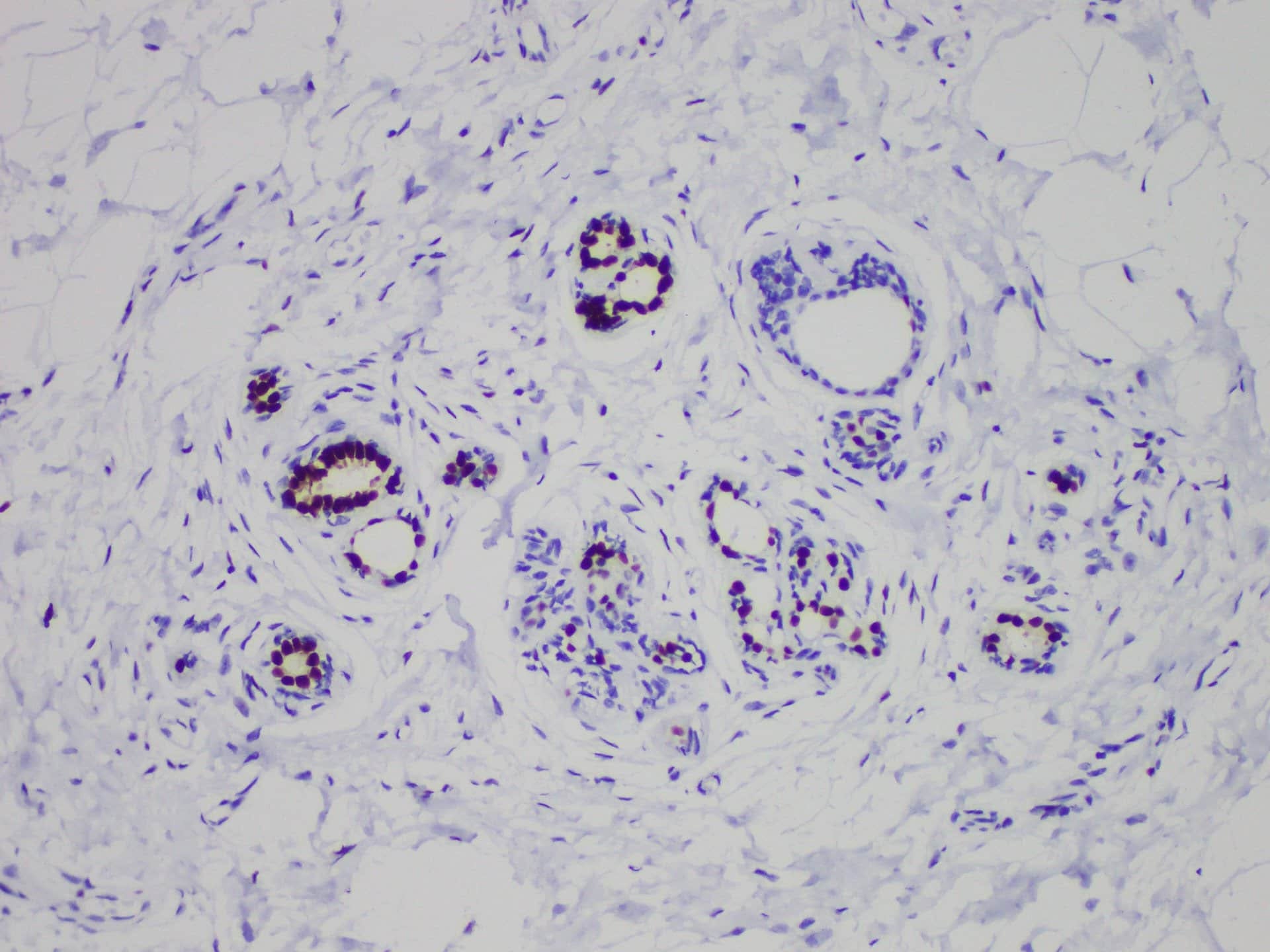 ER Monoclonal Antibody stored at 2~8°C