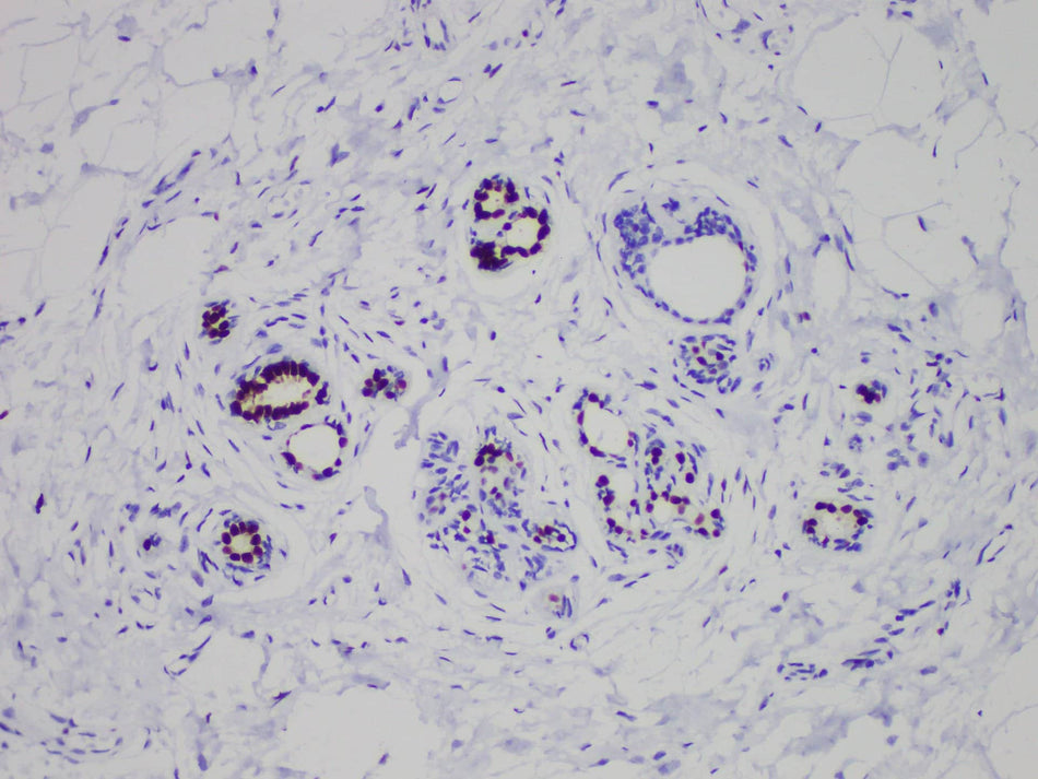 ER Monoclonal Antibody stored at 2~8°C