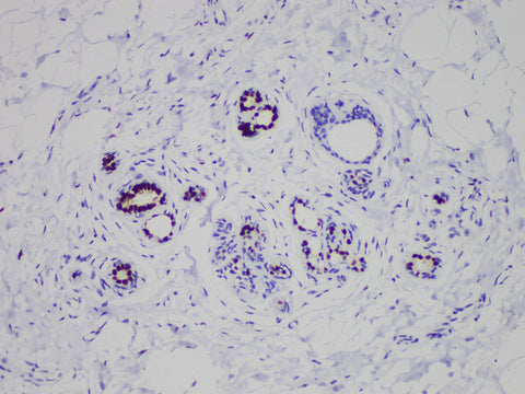 ER Monoclonal Antibody stored at 2~8°C