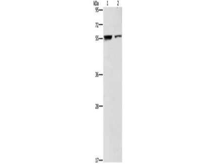 ARHGAP15 Polyclonal Antibody Store at -20°C
