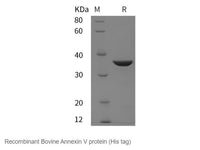 Recombinant Bovine Annexin V protein (His tag) - MSE Supplies LLC
