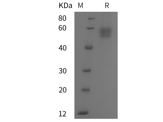 Recombinant Human NPTX2 protein (His tag)