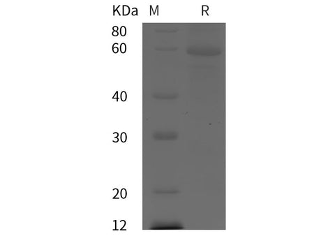 Recombinant Human ADAM8/CD156a protein (His tag)