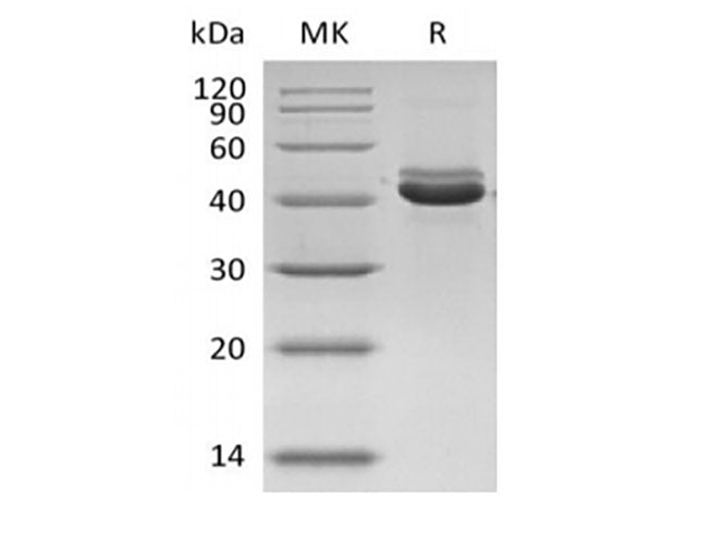 Recombinant Human CD5L/hAIM protein (His tag)