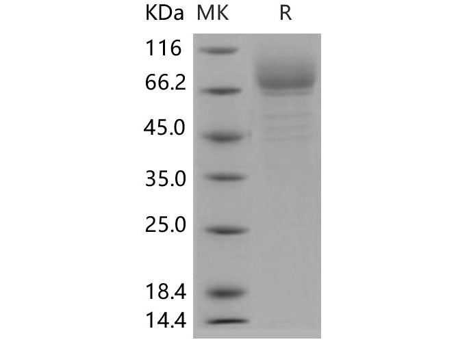 Recombinant Human GP4/CD36 protein (His tag)