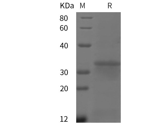 Recombinant Human FCGR1A/CD64 protein (His tag)