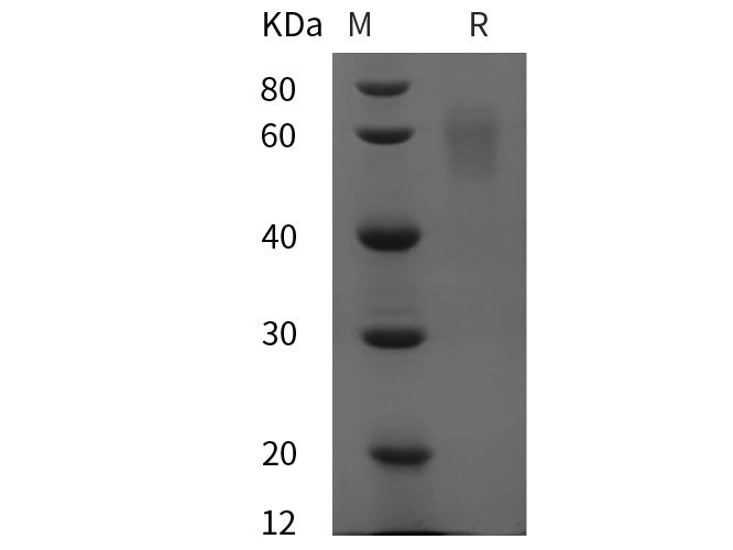 Recombinant Human SerpinA6/CBG protein (His tag)