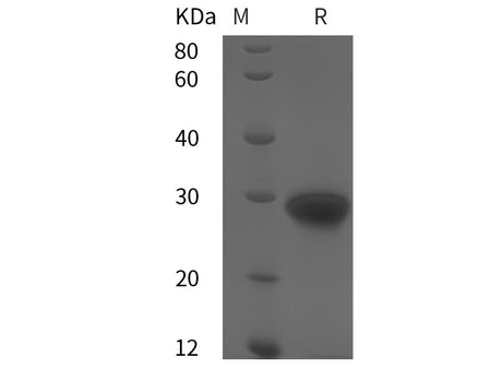 Recombinant Human TIMP-1 protein (His tag)