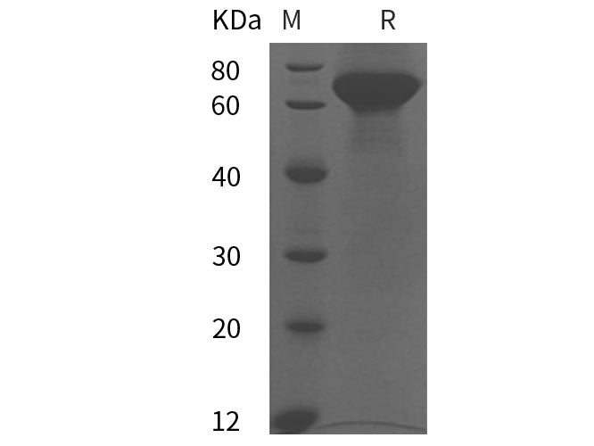 Recombinant Human FGL1/HFREP1 protein (His tag)