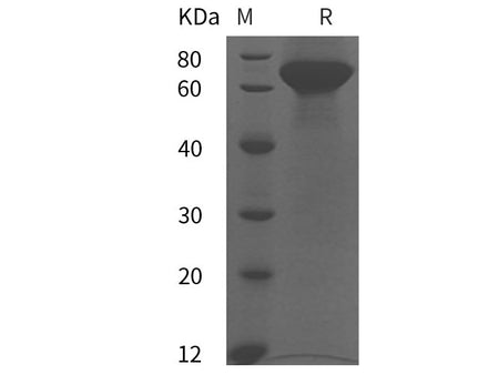 Recombinant Human FGL1/HFREP1 protein (His tag)