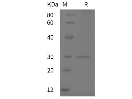 Recombinant Mouse CRP/C-Reactive protein (His tag)