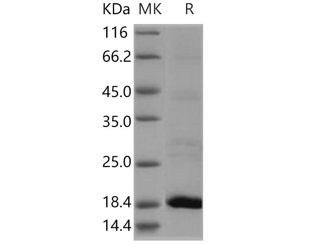 Recombinant Human Flavokinase/RFK Protein (His Tag)