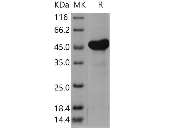 Recombinant Human AK4/AK3L1 Protein (His & GST Tag)