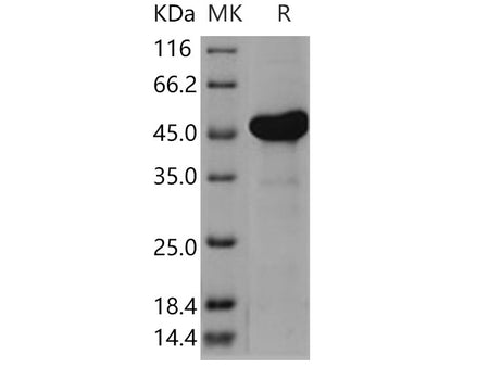 Recombinant Human AK4/AK3L1 Protein (His & GST Tag)