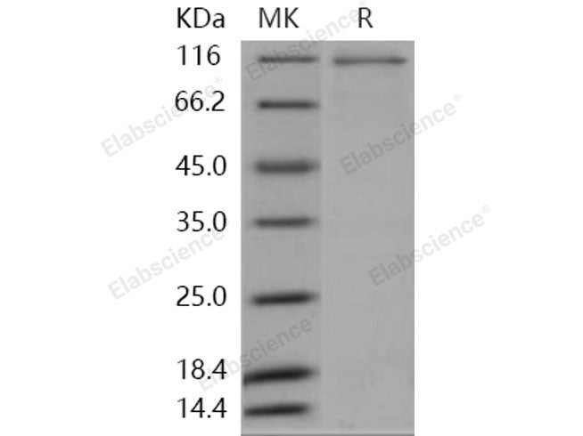 Recombinant Human MAP4K2/GC Kinase Protein (His & GST Tag)