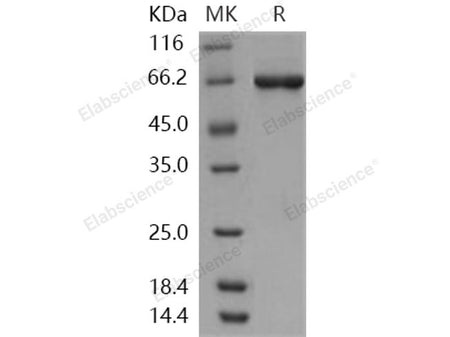 Recombinant Human STK40 Protein (His & GST Tag)