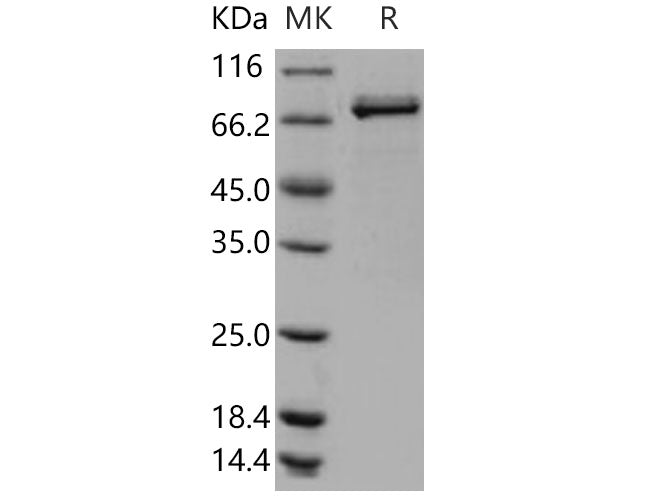 Recombinant Human Lyn Kinase Protein (GST Tag)(Active)