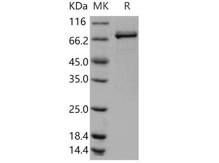 Recombinant Human Lyn Kinase Protein (GST Tag)(Active)