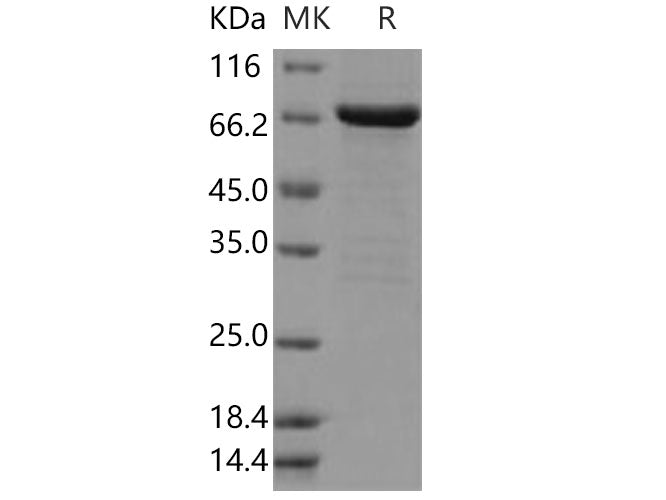 Recombinant Human FGFR2/CD332 Protein (aa 400-821, His & GST Tag)(Active)