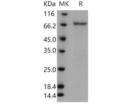 Recombinant Human TPL2/MAP3K8/MEKK8 Protein (GST Tag)