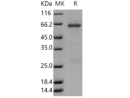 Recombinant Human TRIB3/TRB3 Protein (GST Tag)