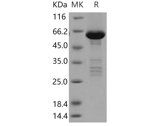 Recombinant Human TRIB2/TRB2 Protein (His & GST Tag)