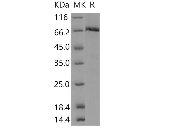 Recombinant Human c-MET/HGFR Protein (aa 956-1390, His & GST Tag)(Active)