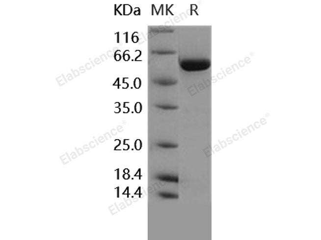 Recombinant Human TGFBR1/ALK-5 Protein (aa 200-503, His & GST Tag)(Active)