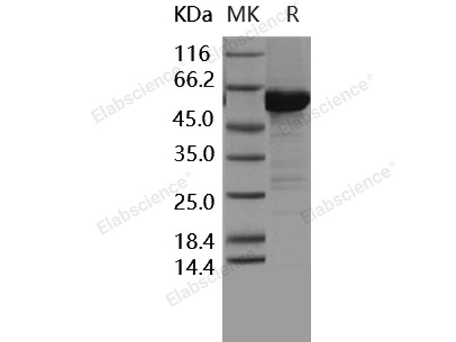 Recombinant Human MKK6 Protein (207 Ser/Asp, 211 Thr/Asp, His & GST Tag)(Active)