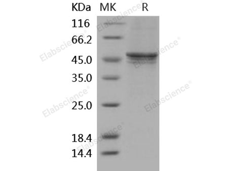 Recombinant Human GSK3B Protein (His Tag)(Active)