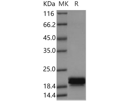 Recombinant Human CNPY2 Protein (His Tag)
