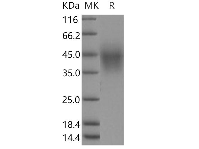 Recombinant Human TMEM25 Protein (His Tag)