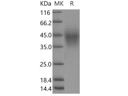 Recombinant Human TMEM25 Protein (His Tag)