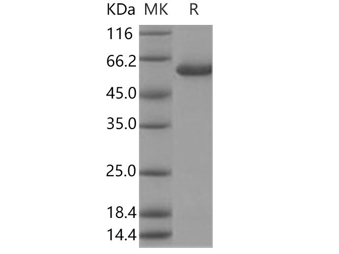 Recombinant Human Galactolipase/PLRP2 Protein (His Tag)
