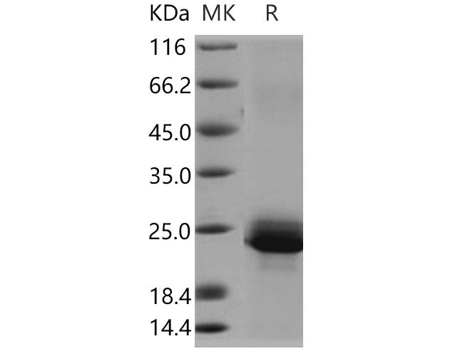 Recombinant Human Serglycin/SRGN Protein (His Tag)
