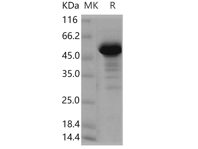 Recombinant Human NCKIPSD/SPIN90 Protein (GST Tag)