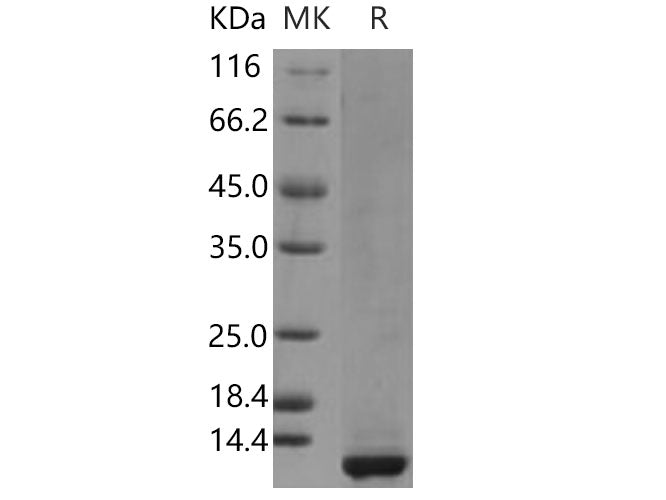 Recombinant Human CLPS/Colipase Protein (His Tag)(Active)