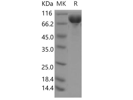 Recombinant Human DCBLD2/ESDN Protein (aa 1-482, His Tag)