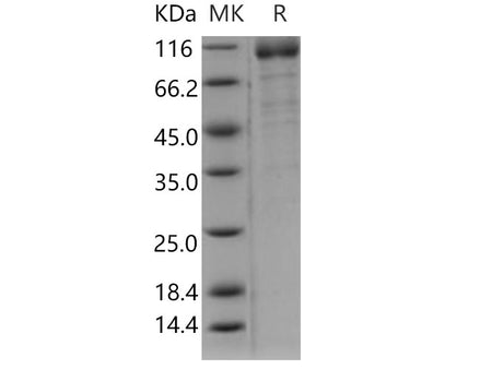 Recombinant Human ILT6/LILRA3 Protein (Fc Tag)